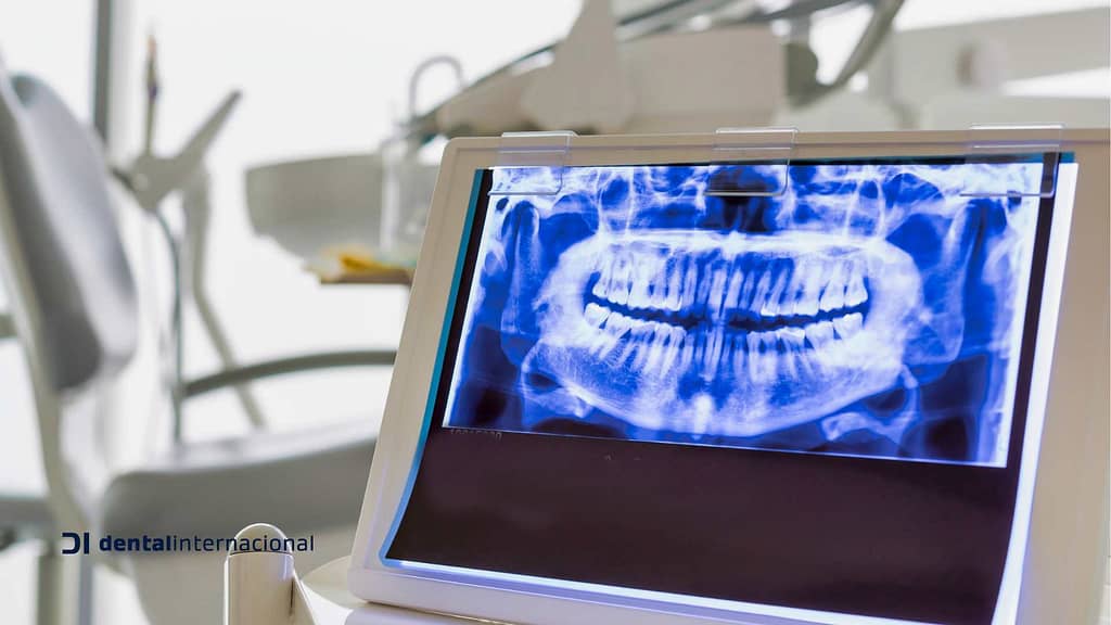 Avances Tecnológicos en las Clínica Dental: Más Allá del Taladro