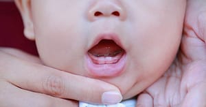 dientes en bebe