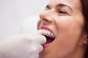 peligros ortodoncia a distancia